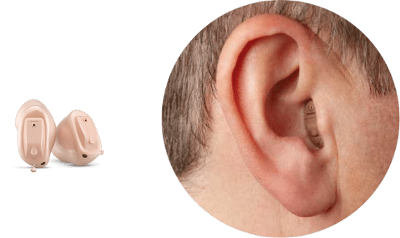 Completely-in-Canal (CIC) hearing aid