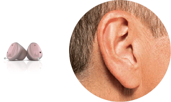 Invisible-In-the-Canal (IIC) hearing aid