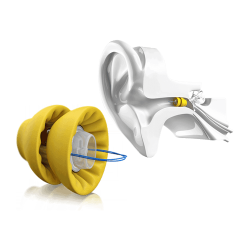 Phonak Lyric extended-wear hearing aid alongside an ear cross-section showing placement