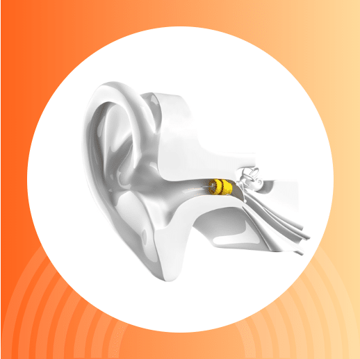 Lyric's invisible hearing aid illustration